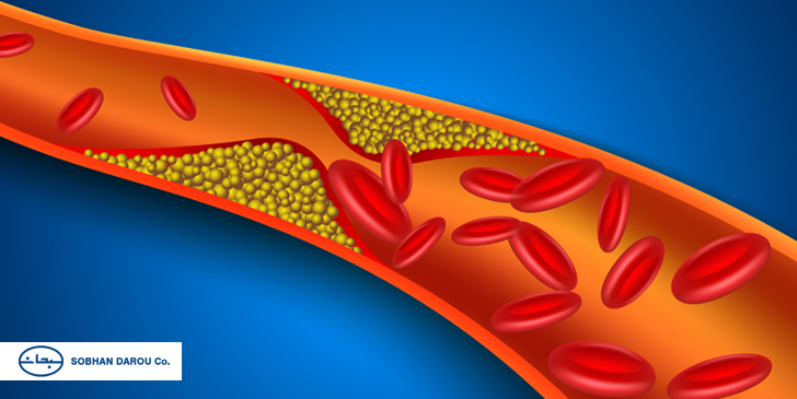 arteriosclerosis